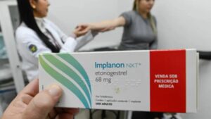 Biguaçu é pioneira no Brasil com Implanon gratuito, que custa até R$ 4 mil em clínicas particulares