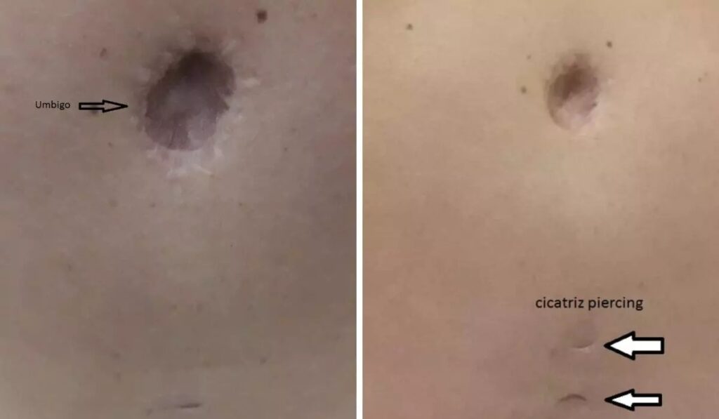 Médico é condenado a cinco anos de prisão por deformar paciente em cirurgia plástica em Florianópolis