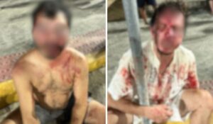 Dois homens são espancados em Florianópolis por suspeita de tentarem sequestrar uma criança